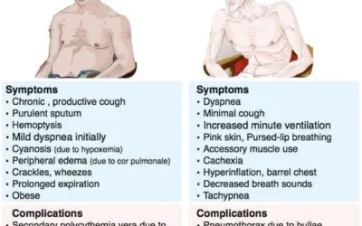 Chronic Bronchitis V/s Emphysema