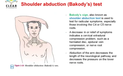 Shoulder abduction (Bakody’s) test